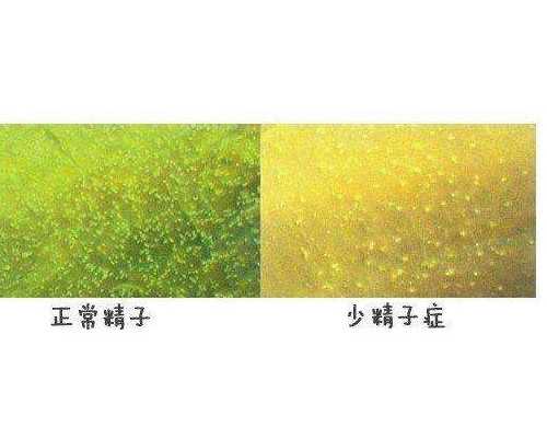 合肥做一个试管生宝宝要花多少钱？ 做试管代孕的流程多久